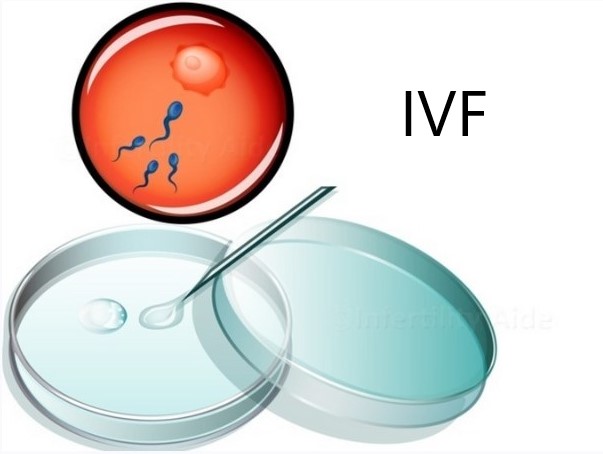 IVF in-vitro umetna oploditev