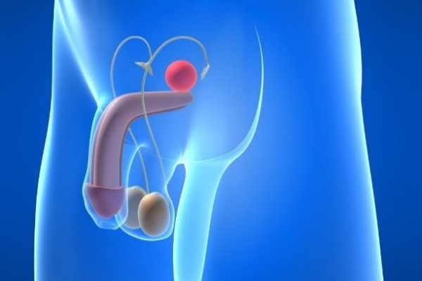 Spermiogram