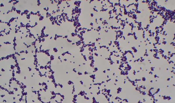 Bakterije Staphylococcus Aureus po Gramu
