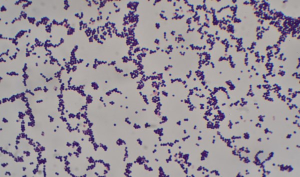 Bakterije Staphylococcus Aureus po Gramu