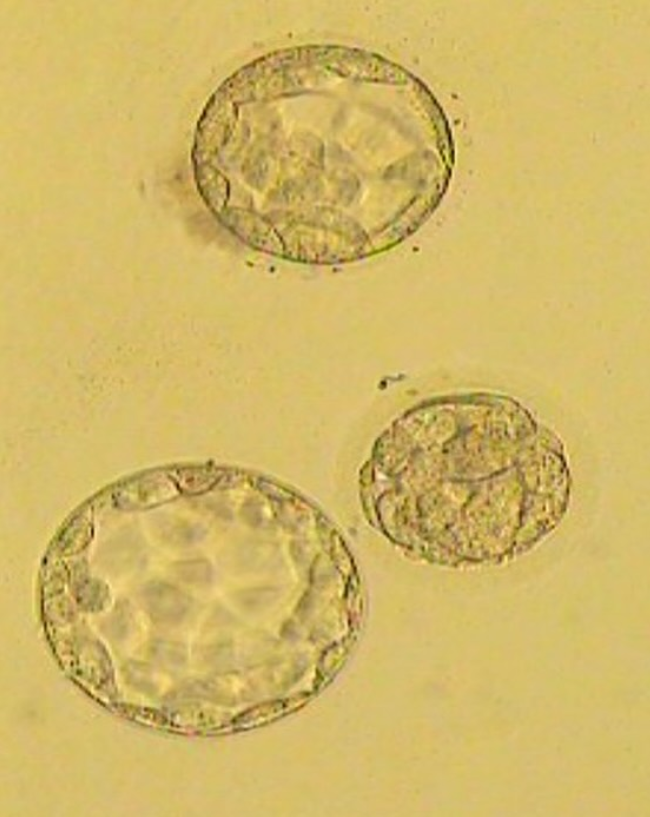 ZD Dravlje IVF umetna oploditev blastocista