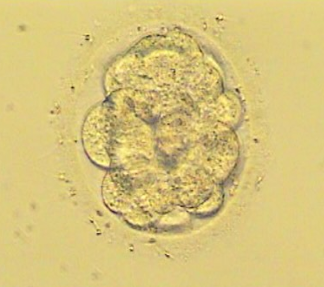 TC Dravlje IVF zdravljenje neplodnosti morula