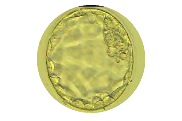 Blastocista_5_dan Blastocista (5. dan razvoja)