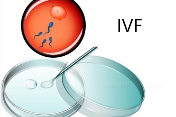 IVF in-vitro